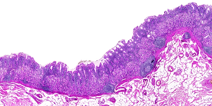 Experimental Pathology